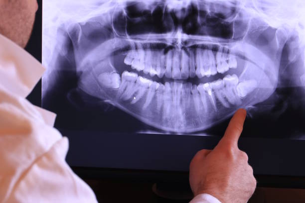 Best Knocked-Out Tooth Emergency  in Westview, FL